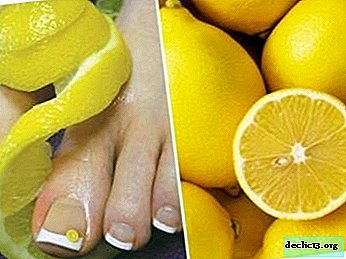 Seente vastu võitlemine käte ja jalgade küüntel: kas sidrun tapab mikroorganisme? Kuidas ravida?
