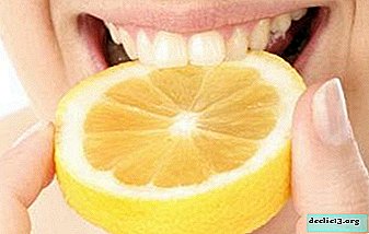 Plusi un mīnusi citronu zobu balināšanai. Efektīvas receptes